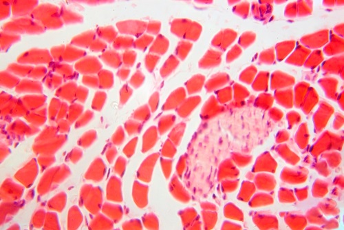 Muscle Biopsy Under Microscope